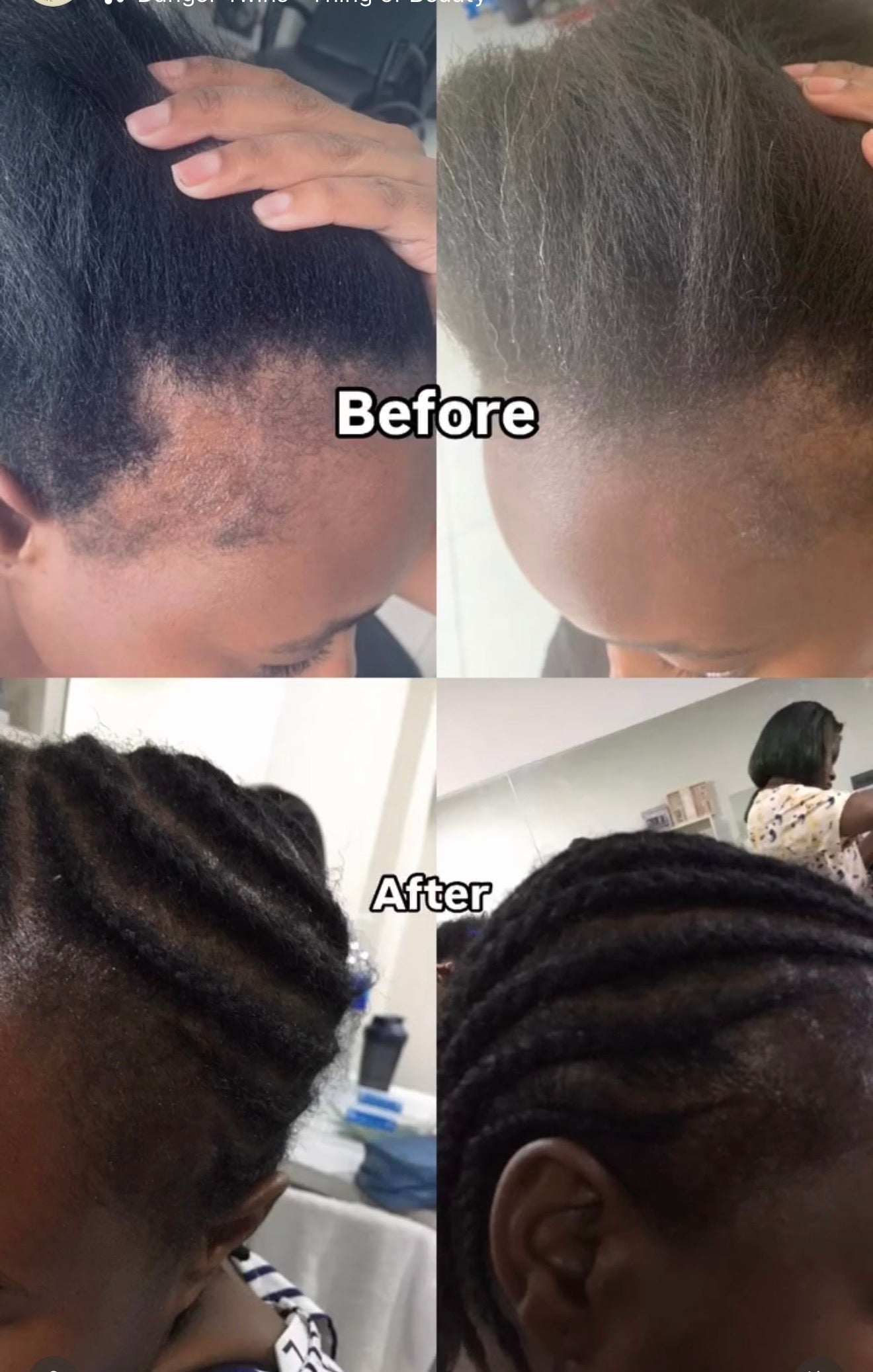 BP Hairline Repair Serum