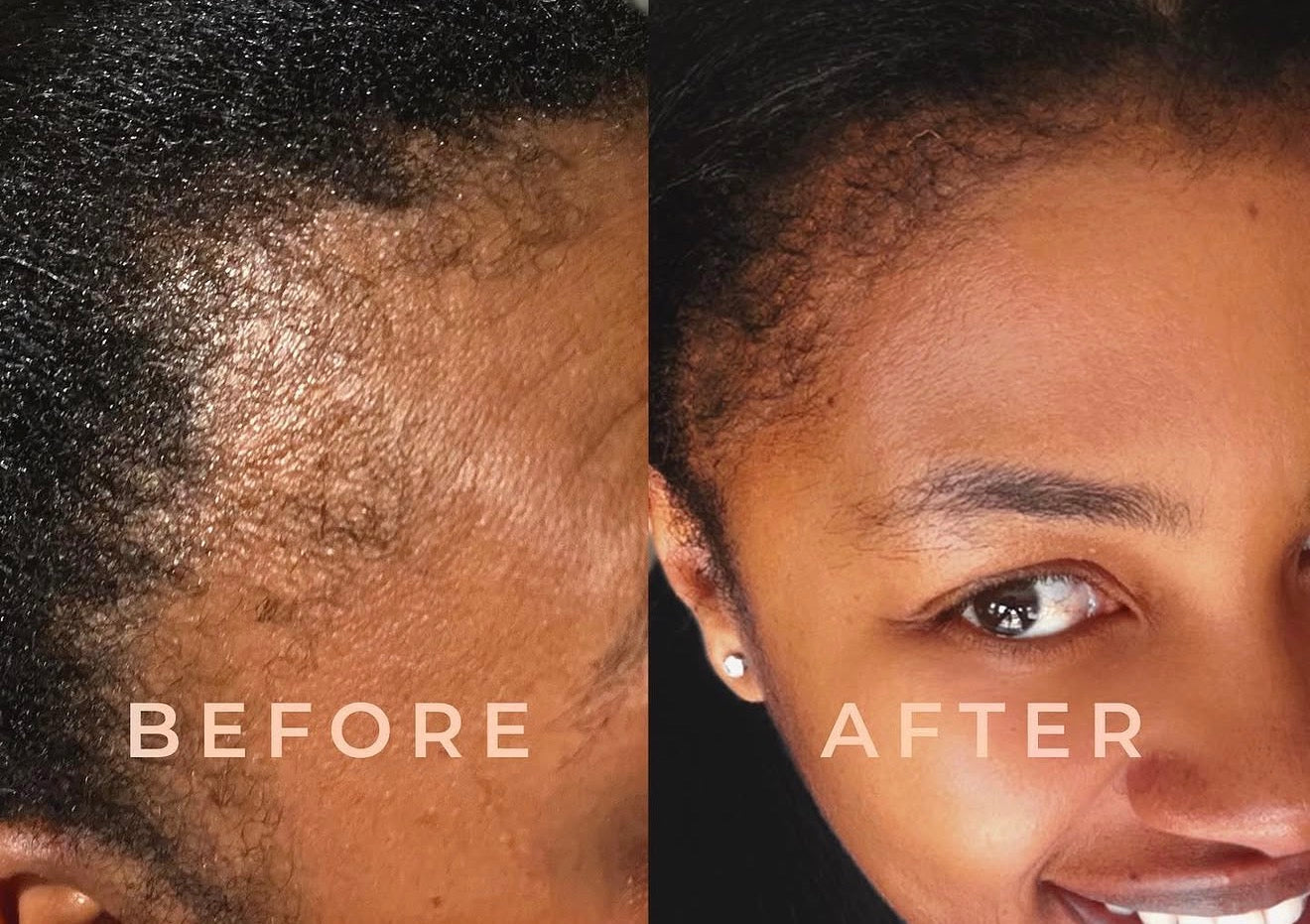 BP Hairline Repair Serum